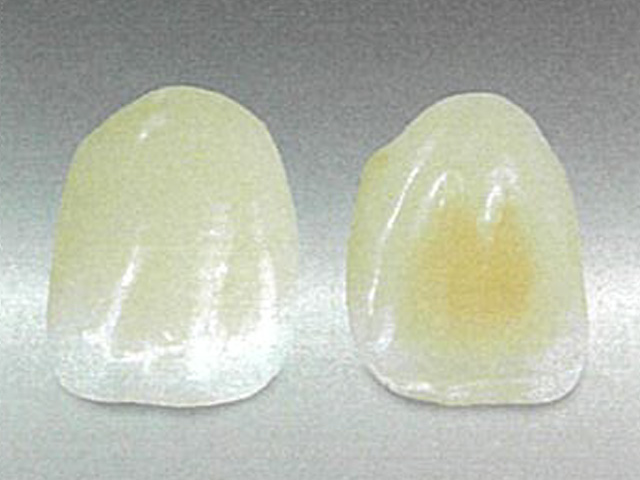 ホワイト e. セラミック・前歯の被せ物